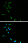 HFE Antibody - Immunofluorescence analysis of MCF-7 cells using HFE antibody. Blue: DAPI for nuclear staining.