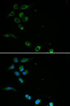 HFE Antibody - Immunofluorescence analysis of MCF-7 cells using HFE antibody. Blue: DAPI for nuclear staining.