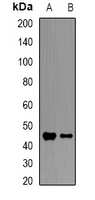 HFE Antibody - Western blot analysis of HFE expression in mouse heart (A); mouse liver (B) whole cell lysates.