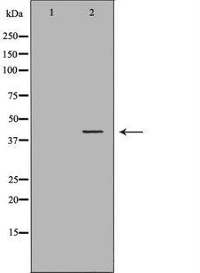 HFE Antibody - Western blot analysis of HeLa whole cells lysates using HFE antibody. The lane on the left is treated with the antigen-specific peptide.