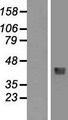 HFE Protein - Western validation with an anti-DDK antibody * L: Control HEK293 lysate R: Over-expression lysate