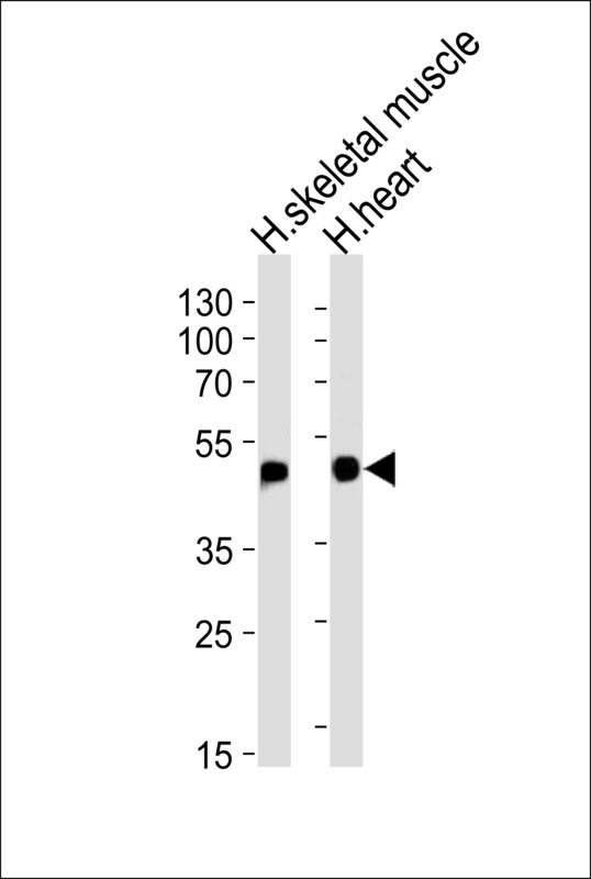 HFE2 / Hemojuvelin Antibody - Western blot of lysates from human skeletal muscle and heart tissue lysates (from left to right), using HFE2 Antibody. Antibody was diluted at 1:1000 at each lane. A goat anti-rabbit IgG H&L (HRP) at 1:5000 dilution was used as the secondary antibody. Lysates at 35ug per lane.