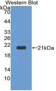 HFE2 / Hemojuvelin Antibody - Western blot of recombinant HFE2 / Hemojuvelin.