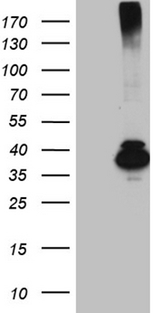 HFE2 / Hemojuvelin Antibody - HEK293T cells were transfected with the pCMV6-ENTRY control. (Left lane) or pCMV6-ENTRY HFE2. (Right lane) cDNA for 48 hrs and lysed. Equivalent amounts of cell lysates. (5 ug per lane) were separated by SDS-PAGE and immunoblotted with anti-HFE2. (1:2000)