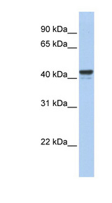 HFH-4 / FOXJ1 Antibody - FOXJ1 antibody Western blot of MCF7 cell lysate. This image was taken for the unconjugated form of this product. Other forms have not been tested.