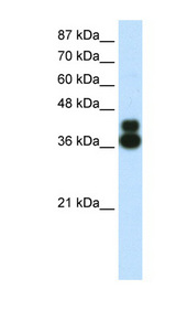HFH-4 / FOXJ1 Antibody - FOXJ1 antibody Western blot of HepG2 cell lysate. This image was taken for the unconjugated form of this product. Other forms have not been tested.