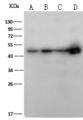 HFH-4 / FOXJ1 Antibody - Anti-FOXJ1 rabbit polyclonal antibody at 1:500 dilution. Lane A: A549 Whole Cell Lysate. Lane B: HepG2 Whole Cell Lysate. Lane C: HeLa Whole Cell Lysate. Lane D: MCF7 Whole Cell Lysate. Lysates/proteins at 30 ug per lane. Secondary: Goat Anti-Rabbit IgG (H+L)/HRP at 1/10000 dilution. Developed using the ECL technique. Performed under reducing conditions. Predicted band size: 45 kDa. Observed band size: 49 kDa.