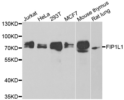 HFip1 / FIP1L1 Antibody - Western blot analysis of extracts of various cell lines.