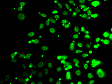 HFip1 / FIP1L1 Antibody - Immunofluorescence analysis of A549 cells.