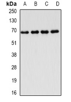 HFip1 / FIP1L1 Antibody - Western blot analysis of FIP1L1 expression in Jurkat (A); MCF7 (B); mouse thymus (C); rat lung (D) whole cell lysates.