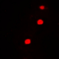 HFip1 / FIP1L1 Antibody - Immunofluorescent analysis of FIP1L1 staining in A549 cells. Formalin-fixed cells were permeabilized with 0.1% Triton X-100 in TBS for 5-10 minutes and blocked with 3% BSA-PBS for 30 minutes at room temperature. Cells were probed with the primary antibody in 3% BSA-PBS and incubated overnight at 4 deg C in a humidified chamber. Cells were washed with PBST and incubated with a DyLight 594-conjugated secondary antibody (red) in PBS at room temperature in the dark.
