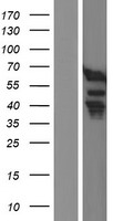 HFip1 / FIP1L1 Protein - Western validation with an anti-DDK antibody * L: Control HEK293 lysate R: Over-expression lysate