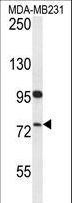 HFM1 Antibody - HFM1 Antibody western blot of MDA-MB231 cell line lysates (35 ug/lane). The HFM1 antibody detected the HFM1 protein (arrow).