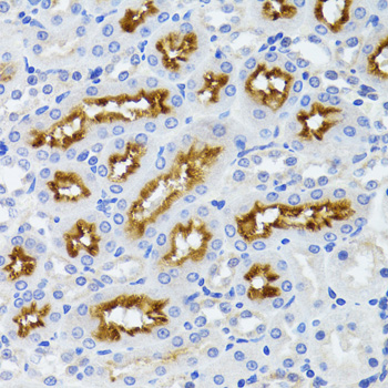 HFM1 Antibody - Immunohistochemistry of paraffin-embedded rat kidney tissue.