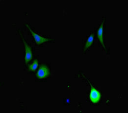 HFM1 Antibody - Immunofluorescent analysis of Hela cells diluted at 1:100 and Alexa Fluor 488-congugated AffiniPure Goat Anti-Rabbit IgG(H+L)