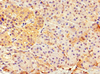 HFM1 Antibody - Immunohistochemistry of paraffin-embedded human pancreatic tissue at dilution 1:100