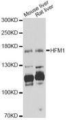 HFM1 Antibody - Western blot analysis of extracts of various cell lines, using HFM1 antibody at 1:1000 dilution. The secondary antibody used was an HRP Goat Anti-Rabbit IgG (H+L) at 1:10000 dilution. Lysates were loaded 25ug per lane and 3% nonfat dry milk in TBST was used for blocking. An ECL Kit was used for detection and the exposure time was 60s.