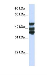 HGD Antibody - Hela cell lysate. Antibody concentration: 1.0 ug/ml. Gel concentration: 12%.  This image was taken for the unconjugated form of this product. Other forms have not been tested.