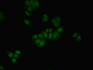 HGD Antibody - Immunofluorescent analysis of Hepg2 cells diluted at 1:100 and Alexa Fluor 488-congugated AffiniPure Goat Anti-Rabbit IgG(H+L)