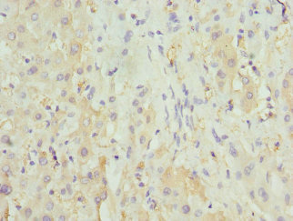 HGD Antibody - Immunohistochemistry of paraffin-embedded human liver tissue at dilution 1:100