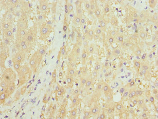 HGD Antibody - Immunohistochemistry of paraffin-embedded human liver tissue at dilution 1:100