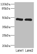 HGD Antibody - Western blot All Lanes: HGDantibody at 2.43ug/ml Lane 1 : Hela whole cell lysate Lane 2 : 293T whole cell lysate Secondary Goat polyclonal to Rabbit IgG at 1/10000 dilution Predicted band size: 50 kDa Observed band size: 50 kDa