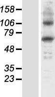 HGD Protein - Western validation with an anti-DDK antibody * L: Control HEK293 lysate R: Over-expression lysate