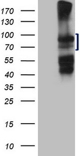 HGF / Hepatocyte Growth Factor Antibody - HEK293T cells were transfected with the pCMV6-ENTRY control. (Left lane) or pCMV6-ENTRY HGF. (Right lane) cDNA for 48 hrs and lysed