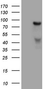 HGF / Hepatocyte Growth Factor Antibody - HEK293T cells were transfected with the pCMV6-ENTRY control. (Left lane) or pCMV6-ENTRY HGF. (Right lane) cDNA for 48 hrs and lysed. Equivalent amounts of cell lysates. (5 ug per lane) were separated by SDS-PAGE and immunoblotted with anti-HGF. (1:2000)