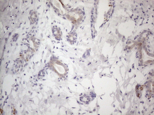 HGF / Hepatocyte Growth Factor Antibody - Immunohistochemical staining of paraffin-embedded Human breast tissue within the normal limits using anti-HGF mouse monoclonal antibody. (Heat-induced epitope retrieval by 1mM EDTA in 10mM Tris buffer. (pH8.5) at 120°C for 3 min. (1:150)