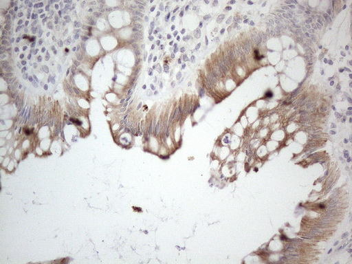 HGF / Hepatocyte Growth Factor Antibody - Immunohistochemical staining of paraffin-embedded Human colon tissue within the normal limits using anti-HGF mouse monoclonal antibody. (Heat-induced epitope retrieval by 1mM EDTA in 10mM Tris buffer. (pH8.5) at 120°C for 3 min. (1:150)