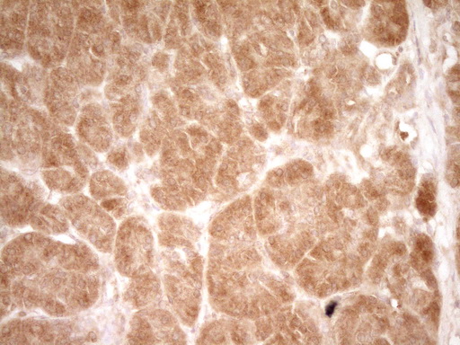 HGF / Hepatocyte Growth Factor Antibody - Immunohistochemical staining of paraffin-embedded Human pancreas tissue within the normal limits using anti-HGF mouse monoclonal antibody. (Heat-induced epitope retrieval by 1 mM EDTA in 10mM Tris, pH8.5, 120C for 3min,