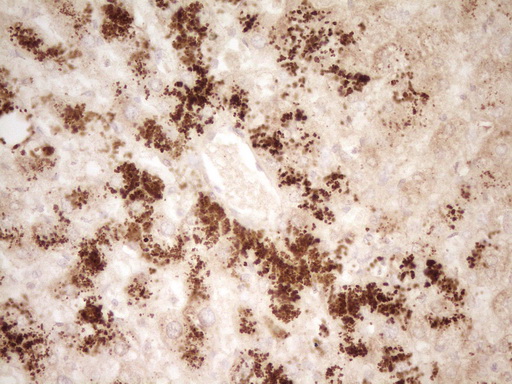 HGF / Hepatocyte Growth Factor Antibody - Immunohistochemical staining of paraffin-embedded Human liver tissue within the normal limits using anti-HGF mouse monoclonal antibody. (Heat-induced epitope retrieval by 1 mM EDTA in 10mM Tris, pH8.5, 120C for 3min,