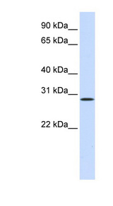 HGF / Hepatocyte Growth Factor Antibody - HGF antibody Western blot of Placenta lysate. This image was taken for the unconjugated form of this product. Other forms have not been tested.