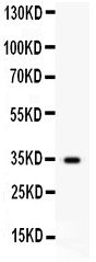 HGF / Hepatocyte Growth Factor Antibody - HGF antibody Western blot. All lanes: Anti HGF at 0.5 ug/ml. WB: NIH Whole Cell Lysate at 40 ug. Predicted band size: 34 kD. Observed band size: 34 kD.
