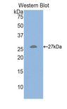 HGF / Hepatocyte Growth Factor Antibody - Western blot of recombinant HGF.  This image was taken for the unconjugated form of this product. Other forms have not been tested.