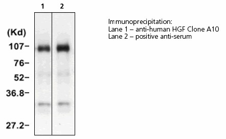 HGF / Hepatocyte Growth Factor Antibody