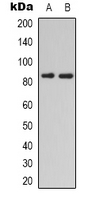 HGF / Hepatocyte Growth Factor Antibody - Western blot analysis of HGF expression in HEK293T (A); SHSY5Y (B) whole cell lysates.