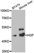 HGF / Hepatocyte Growth Factor Antibody - Western blot analysis of extracts of various cell lines.