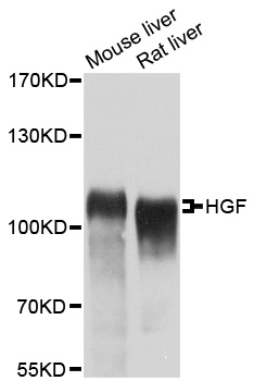 HGF / Hepatocyte Growth Factor Antibody - Western blot analysis of extracts of various cell lines, using HGF antibody at 1:400 dilution. The secondary antibody used was an HRP Goat Anti-Rabbit IgG (H+L) at 1:10000 dilution. Lysates were loaded 25ug per lane and 3% nonfat dry milk in TBST was used for blocking. An ECL Kit was used for detection and the exposure time was 60s.