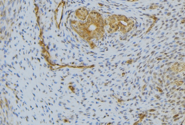 HGF / Hepatocyte Growth Factor Antibody - 1:100 staining human uterus tissue by IHC-P. The sample was formaldehyde fixed and a heat mediated antigen retrieval step in citrate buffer was performed. The sample was then blocked and incubated with the antibody for 1.5 hours at 22°C. An HRP conjugated goat anti-rabbit antibody was used as the secondary.
