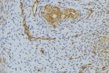 HGF / Hepatocyte Growth Factor Antibody - 1:100 staining human uterus tissue by IHC-P. The sample was formaldehyde fixed and a heat mediated antigen retrieval step in citrate buffer was performed. The sample was then blocked and incubated with the antibody for 1.5 hours at 22°C. An HRP conjugated goat anti-rabbit antibody was used as the secondary.