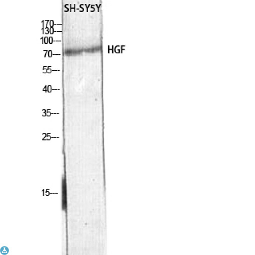 HGF / Hepatocyte Growth Factor Antibody - Western Blot (WB) analysis of SH-SY5Y lysis using HGF antibody.