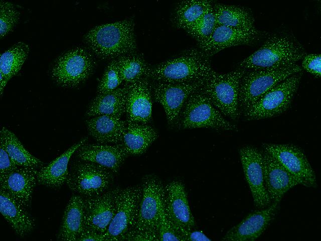HGF / Hepatocyte Growth Factor Antibody - Immunofluorescence staining of HGF in U2OS cells. Cells were fixed with 4% PFA, permeabilzed with 0.1% Triton X-100 in PBS, blocked with 10% serum, and incubated with rabbit anti-Human HGF polyclonal antibody (dilution ratio 1:200) at 4°C overnight. Then cells were stained with the Alexa Fluor 488-conjugated Goat Anti-rabbit IgG secondary antibody (green) and counterstained with DAPI (blue). Positive staining was localized to Cytoplasm.