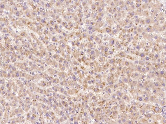 HGF / Hepatocyte Growth Factor Antibody - Immunochemical staining of human HGF in human liver with rabbit polyclonal antibody at 1:200 dilution, formalin-fixed paraffin embedded sections.