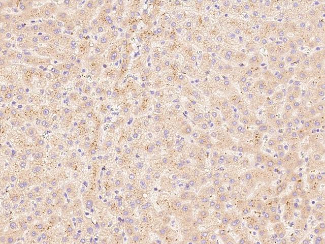 HGF / Hepatocyte Growth Factor Antibody - Immunochemical staining of human HGF in human liver with rabbit polyclonal antibody at 1:500 dilution, formalin-fixed paraffin embedded sections.