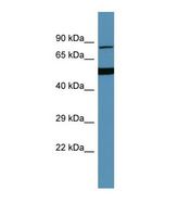 HGFAC / HGFA Antibody - Western blot of Human THP-1. HGFAC antibody dilution 1.0 ug/ml.  This image was taken for the unconjugated form of this product. Other forms have not been tested.