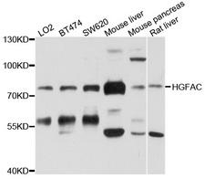 HGFAC / HGFA Antibody - Western blot analysis of extracts of various cell lines, using HGFAC antibody at 1:1000 dilution. The secondary antibody used was an HRP Goat Anti-Rabbit IgG (H+L) at 1:10000 dilution. Lysates were loaded 25ug per lane and 3% nonfat dry milk in TBST was used for blocking. An ECL Kit was used for detection and the exposure time was 30s.