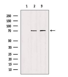 HGFAC / HGFA Antibody - Western blot analysis of extracts of various samples using HGFAC antibody. Lane 1: c476 treated with blocking peptide. Lane 2: c476; Lane 3: 293;