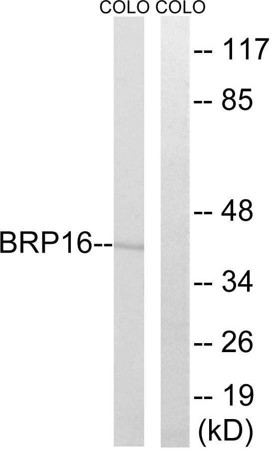 HGH1 / FAM203A Antibody - Western blot analysis of lysates from COLO cells, using BRP16 Antibody. The lane on the right is blocked with the synthesized peptide.